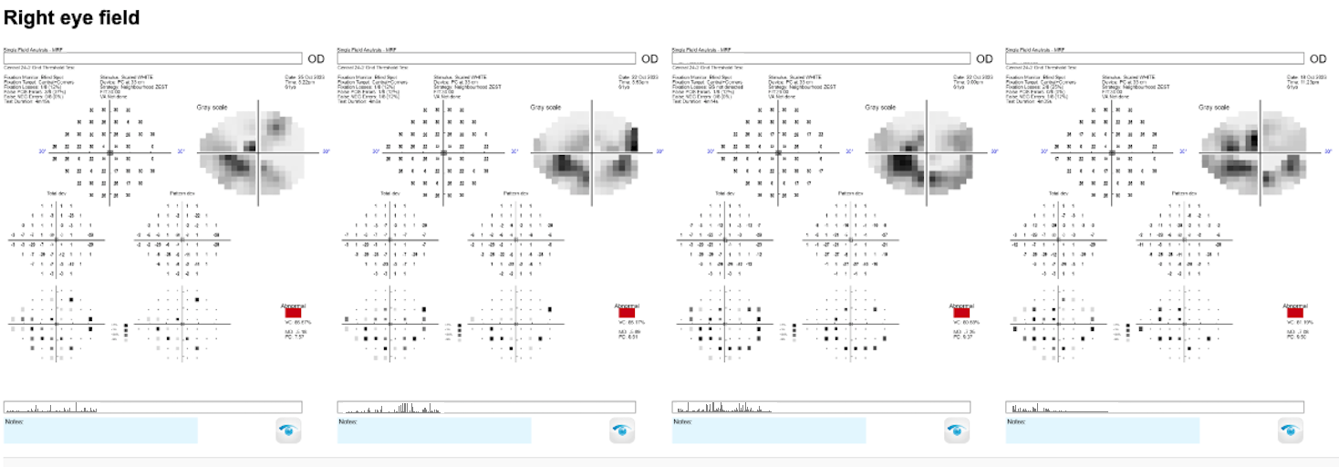 Progression_Analysis
