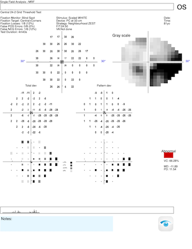 moderate
