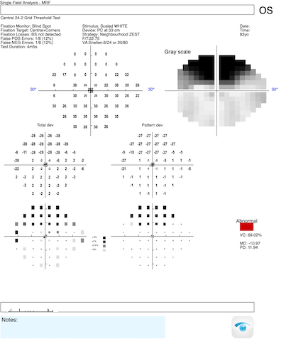 moderate2