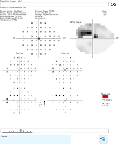 paracentral